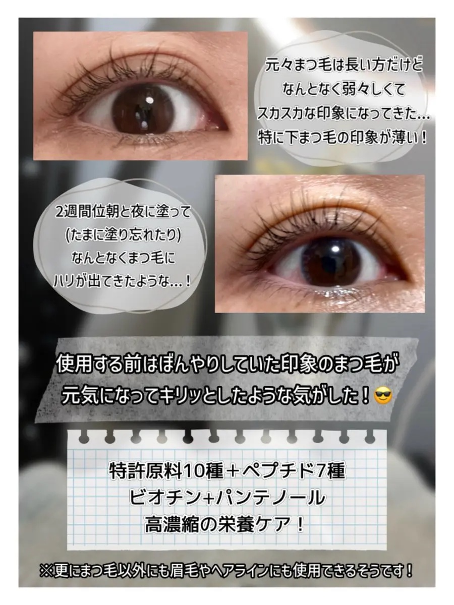 アイラッシュエッセンシャルセラム/epais/まつげ美容液を使ったクチコミ（3枚目）