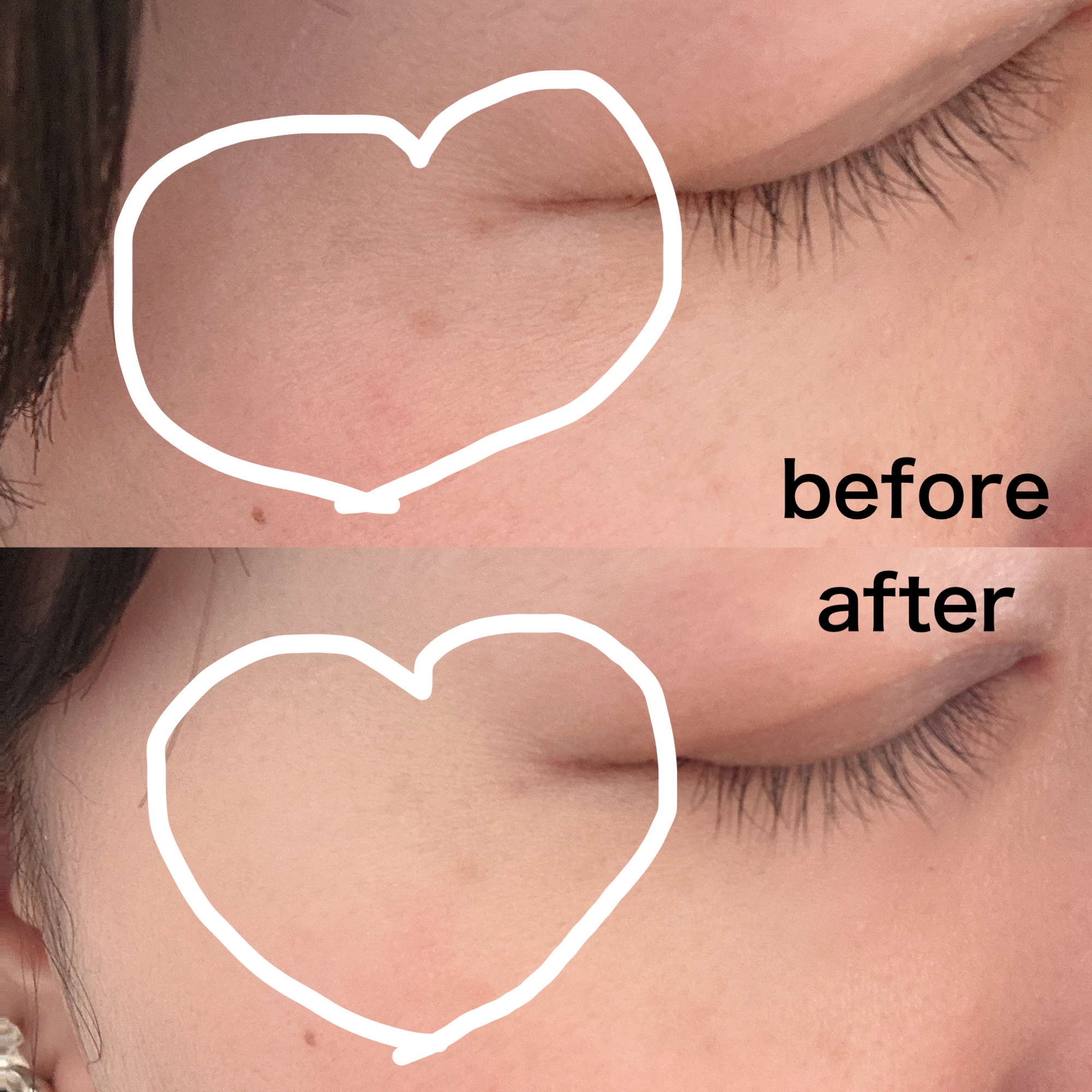 SHISEIDO　シンクロスキン　ラディアントリフティング　コンシーラー/SHISEIDO/スティックコンシーラーを使ったクチコミ（3枚目）