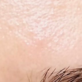 ガーリック リードルショット スポットクリーム/VT/フェイスクリームを使ったクチコミ(5枚目)