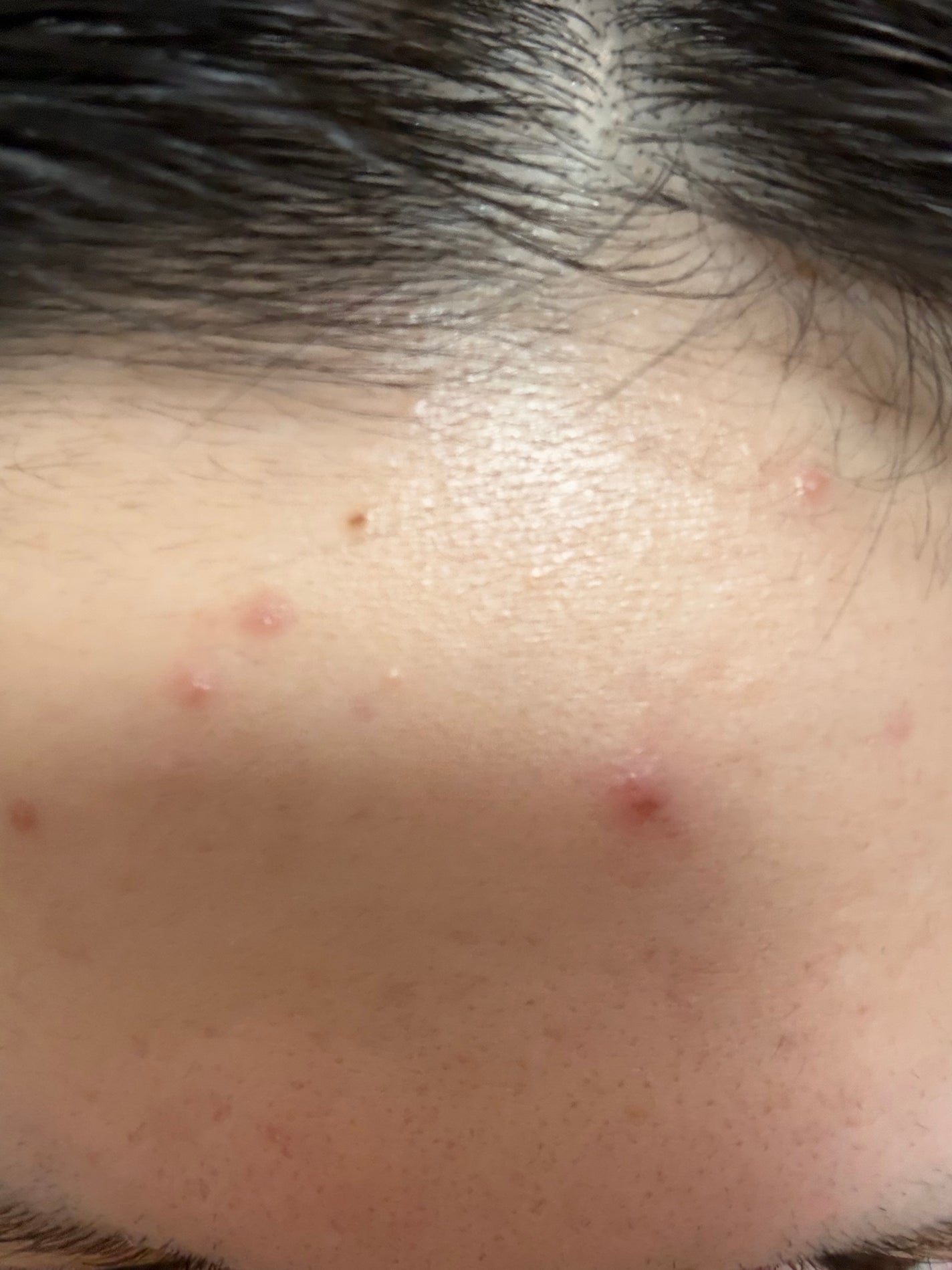 潤浸保湿 化粧水 III とてもしっとり/キュレル/化粧水を使ったクチコミ(3枚目)