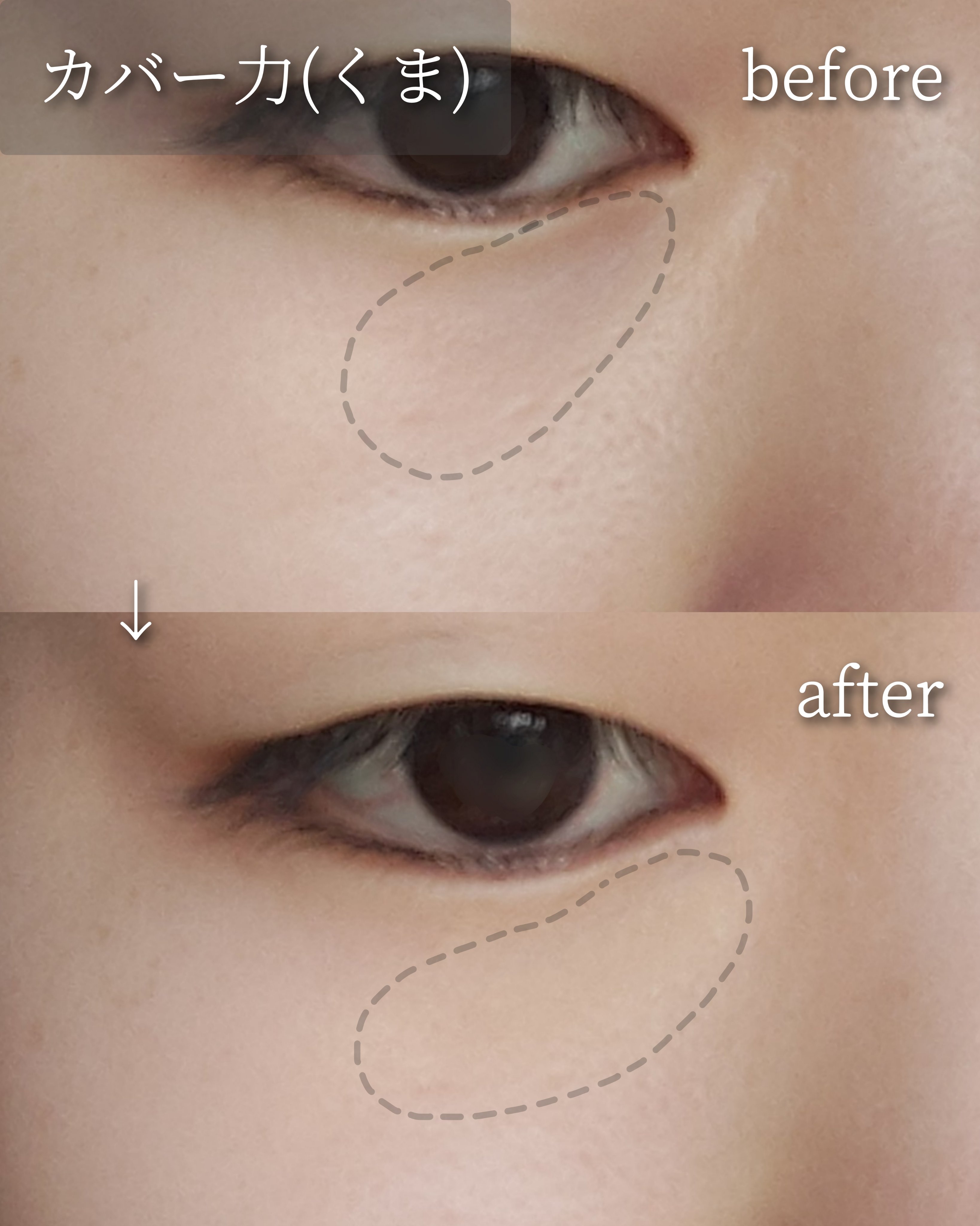 ロングラスティングチップコンシーラー/LUNA/リキッドコンシーラーを使ったクチコミ（3枚目）