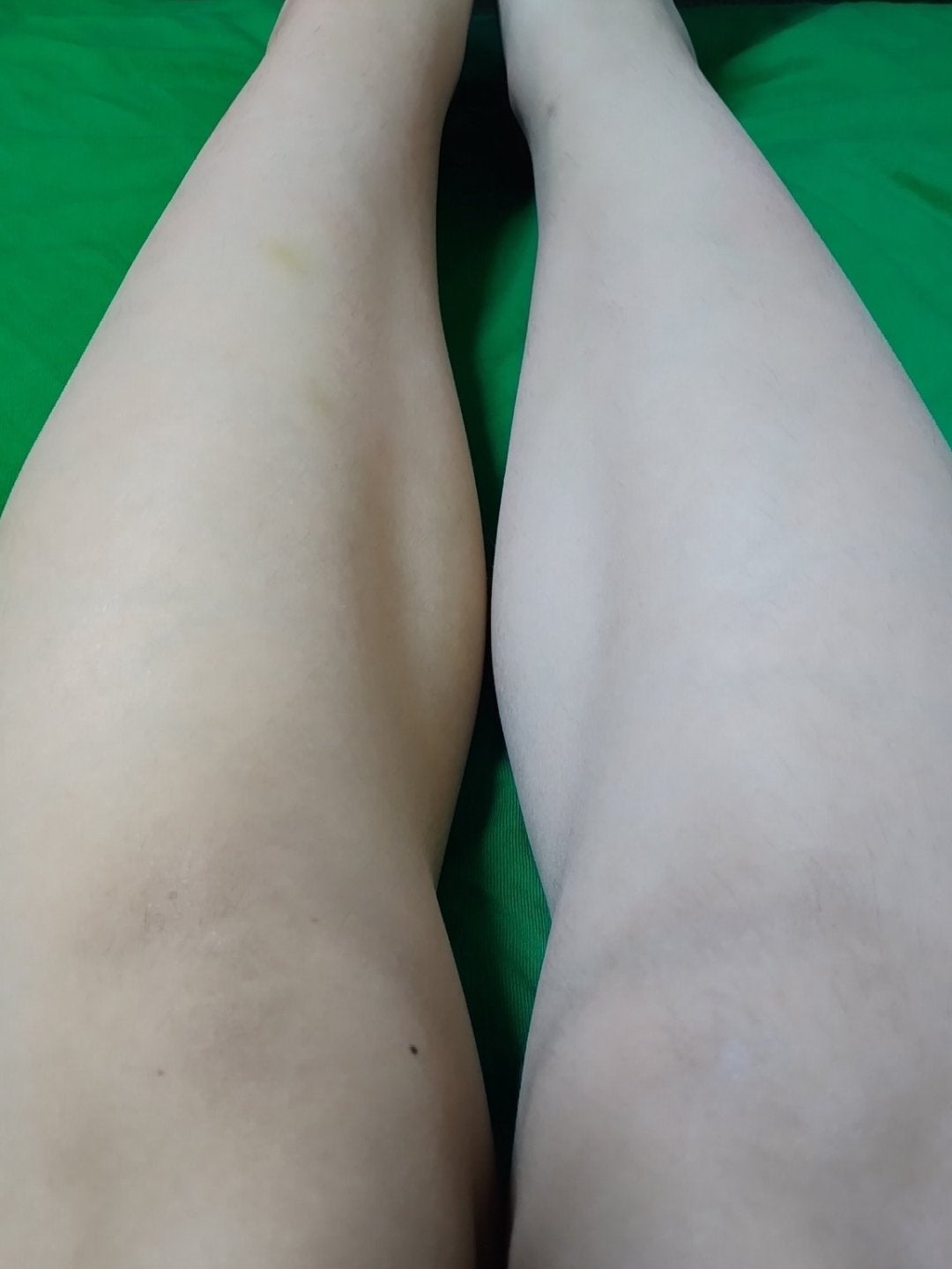 ブライトピュアパック/CandyDoll/洗い流すパック・マスクを使ったクチコミ(4枚目)