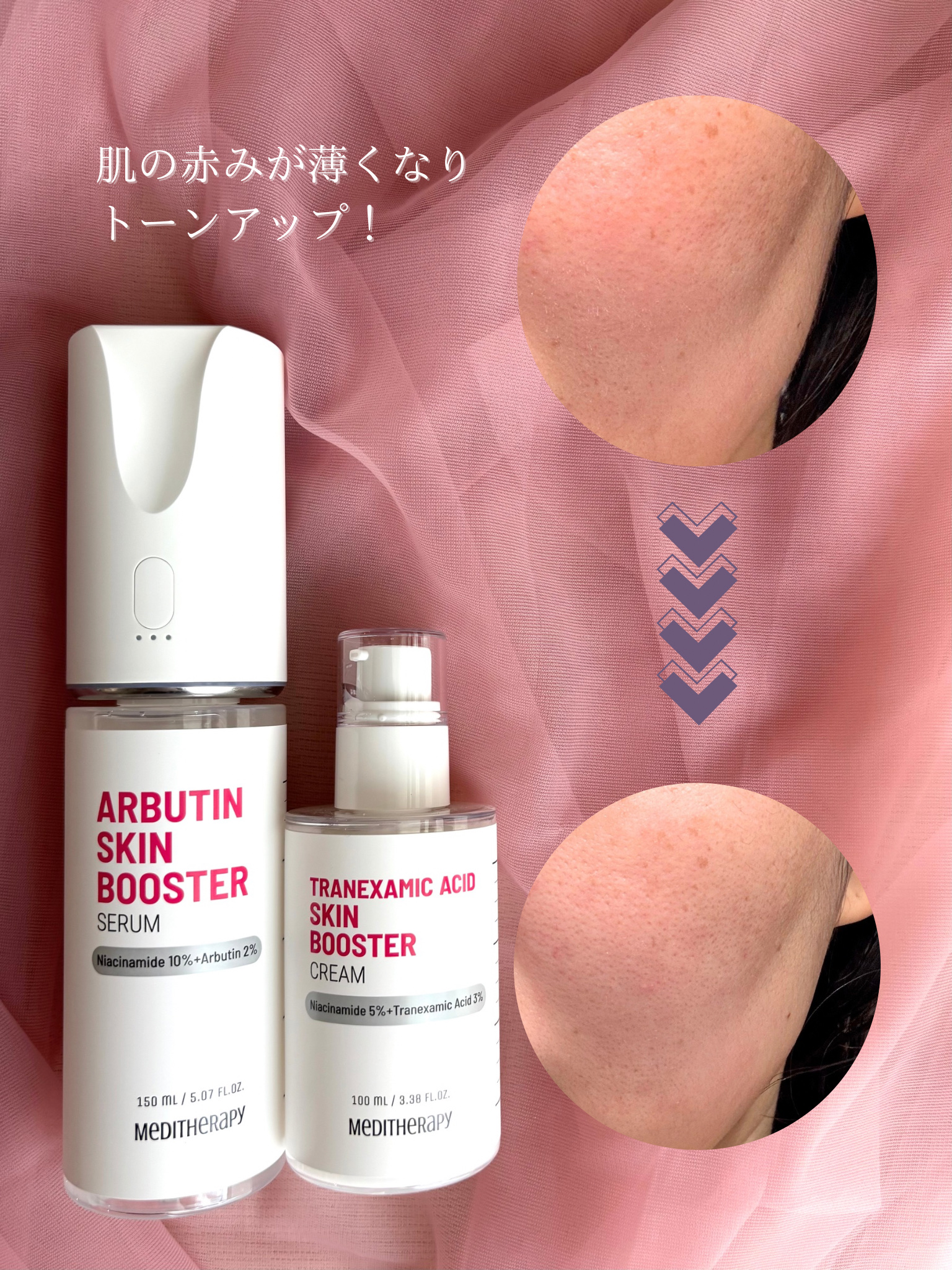 を使ったクチコミ（3枚目）