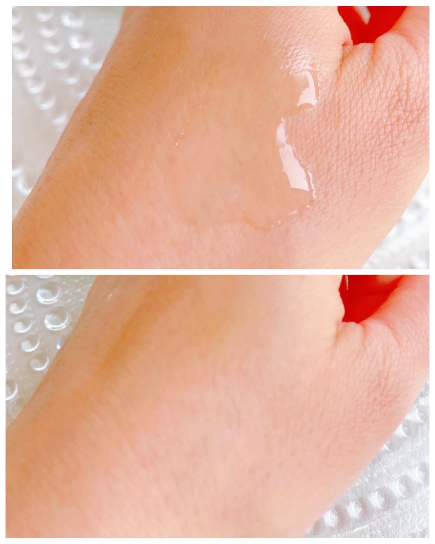 ダーマアンサーアゼライン酸ミントアンプル/CNP Laboratory/美容液を使ったクチコミ（3枚目）