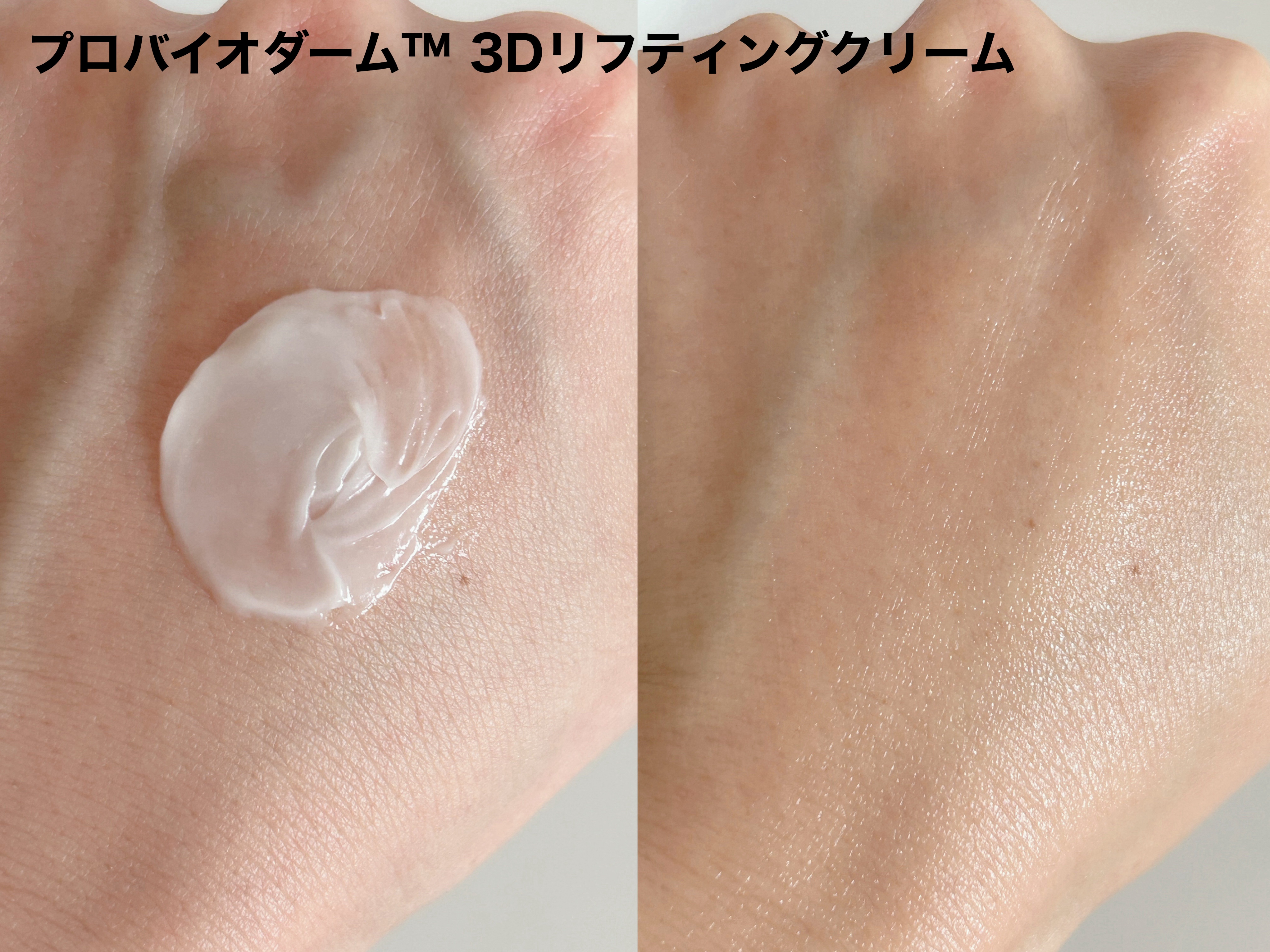 バイオヒールボ プロバイオダーム 3Dリフティングクリーム/BIOHEAL BOH/フェイスクリームを使ったクチコミ（3枚目）