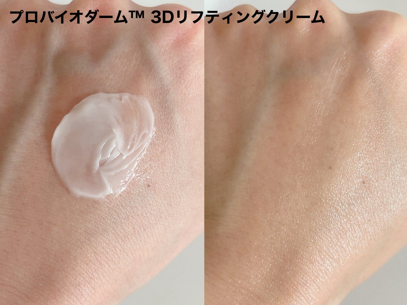 ãã€ãªããŒã«ã ãããã€ãªããŒã 3Dãªããã£ã³ã°ã¯ãªãŒã /BIOHEAL BOH/ãã§ã€ã¹ã¯ãªãŒã ã䜿ã£ãã¯ãã³ãïŒ3æç®ïŒ