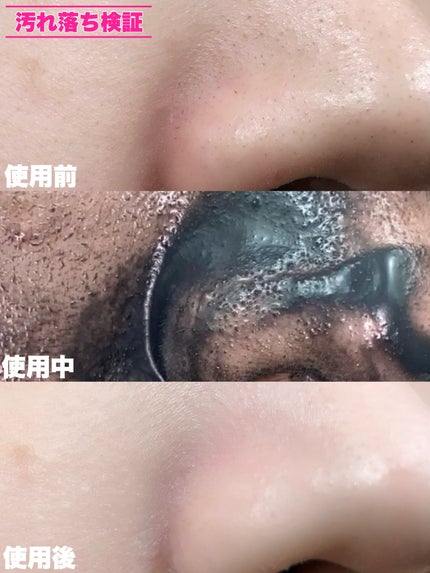 スムースクレンジングバーム ディープブラック GL+/PERFECT ONE FOCUS/クレンジングバームを使ったクチコミ(6枚目)