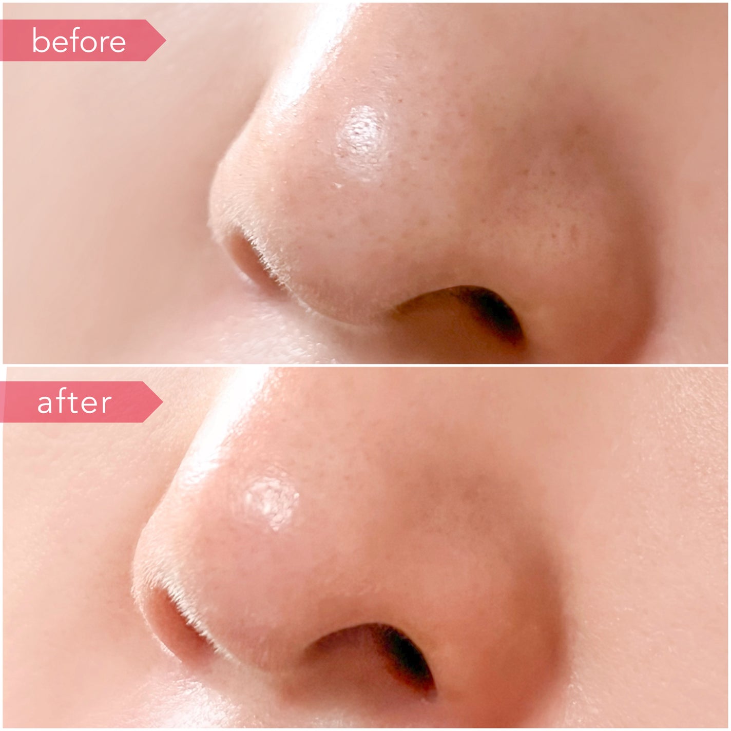 AZケア クレンジングオイル/VT/オイルクレンジングを使ったクチコミ(7枚目)