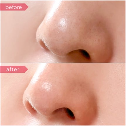 AZケア クレンジングオイル/VT/オイルクレンジングを使ったクチコミ(7枚目)