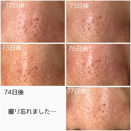 レチノール0.3 ナイアシンリニューイングセラム/Anua/美容液を使ったクチコミ(5枚目)