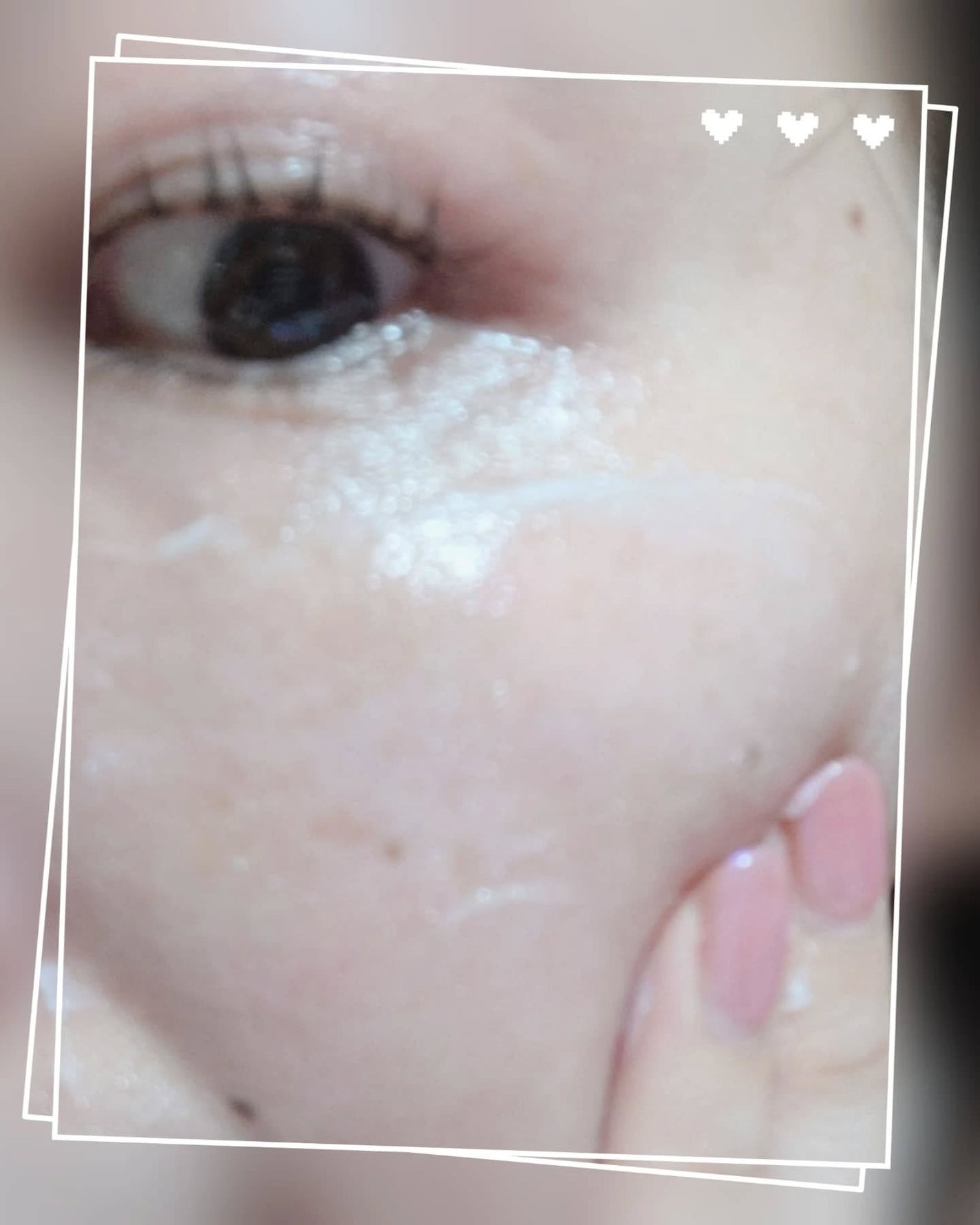 アトバリア365クリーム/AESTURA/フェイスクリームを使ったクチコミ(7枚目)