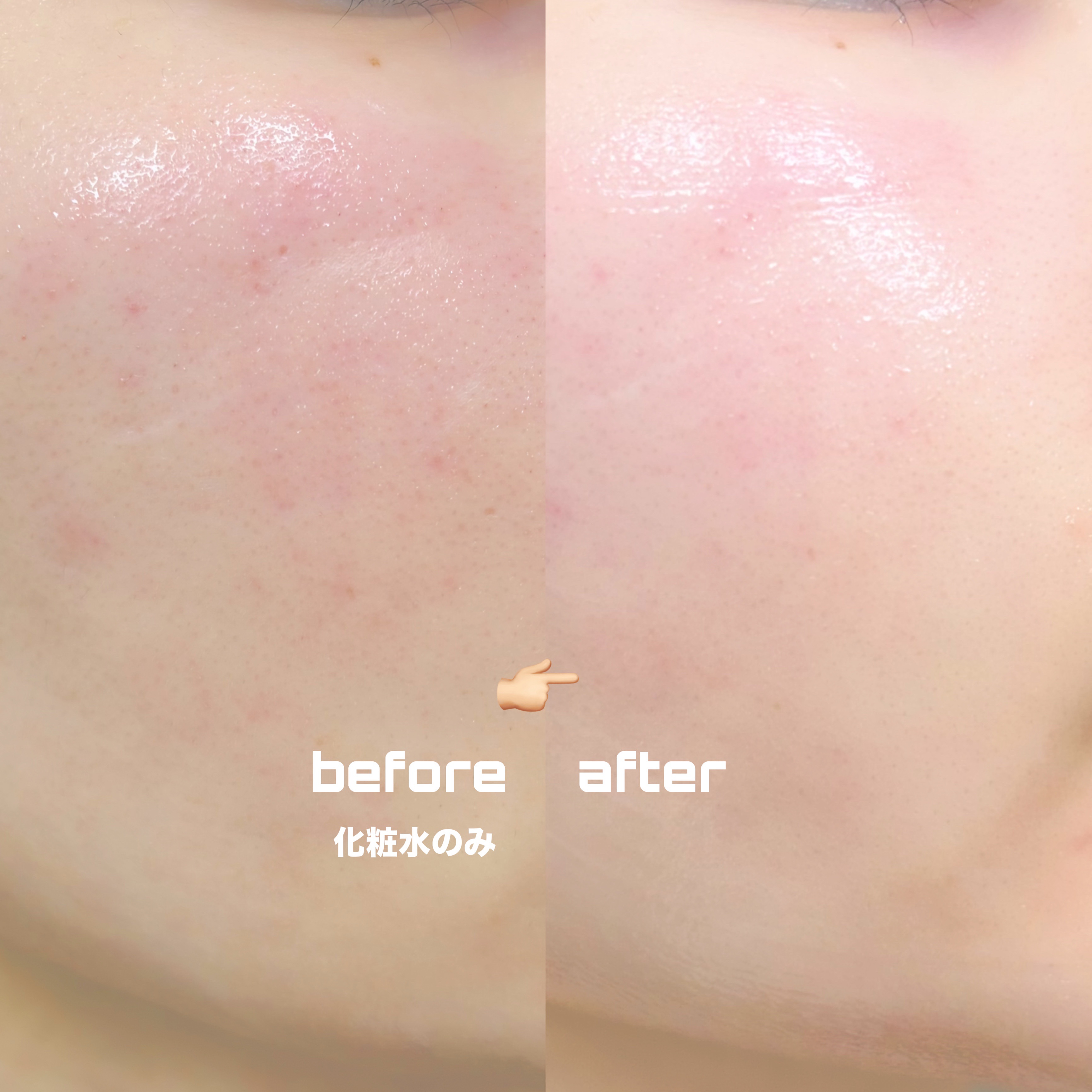 レッドモチセラム30/アレンシア/美容液を使ったクチコミ（3枚目）