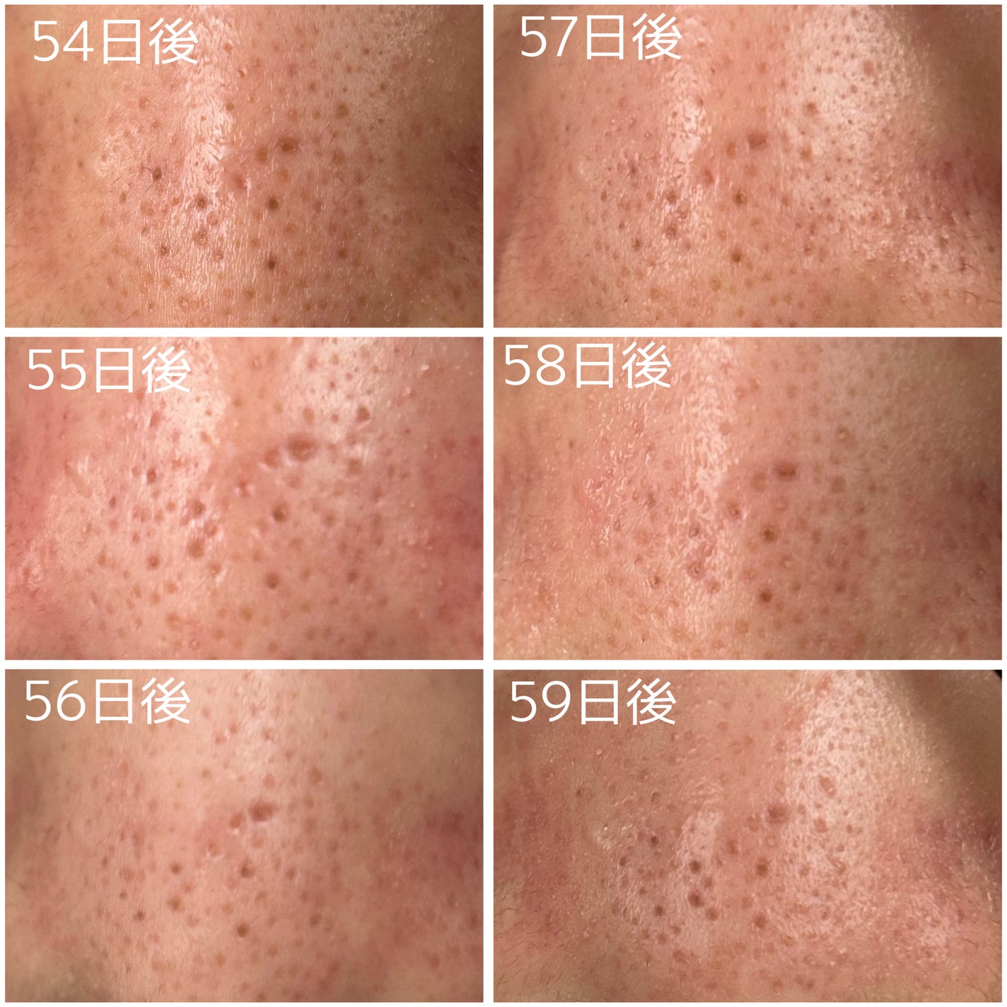 レチノール0.3 ナイアシンリニューイングセラム/Anua/美容液を使ったクチコミ(2枚目)