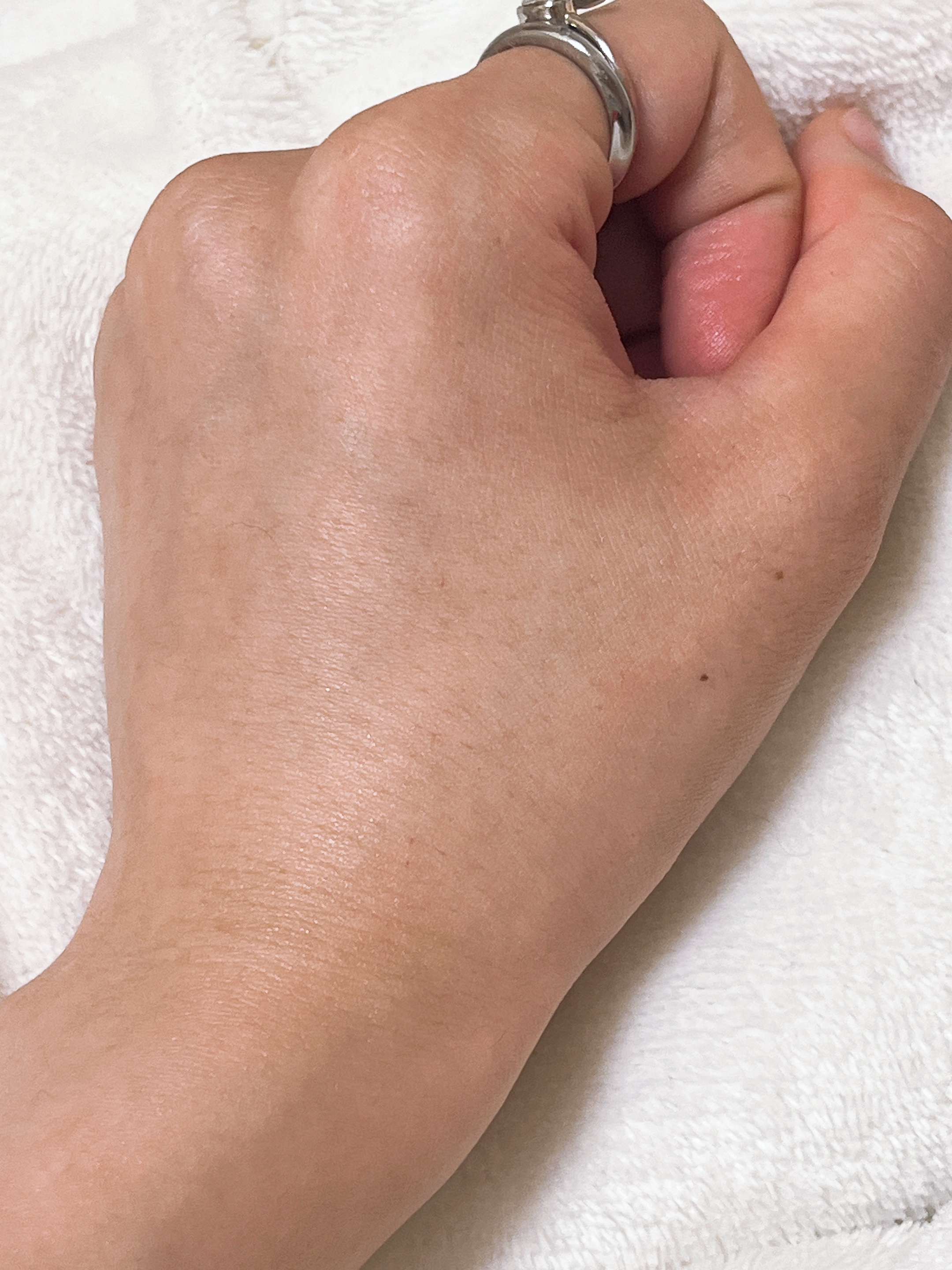 レッドモチセラム30/アレンシア/美容液を使ったクチコミ（3枚目）