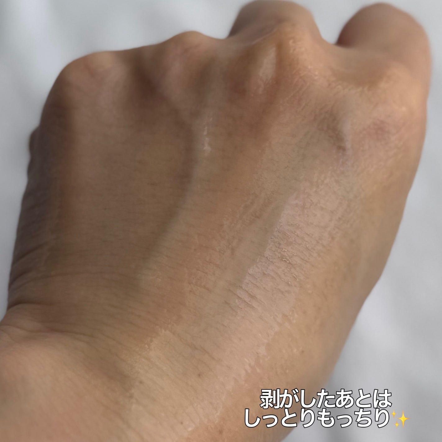 Kara on LIPS 「Ariul様よりご提供いただきました。❤︎エキスパートナイアシ..」(6枚目)