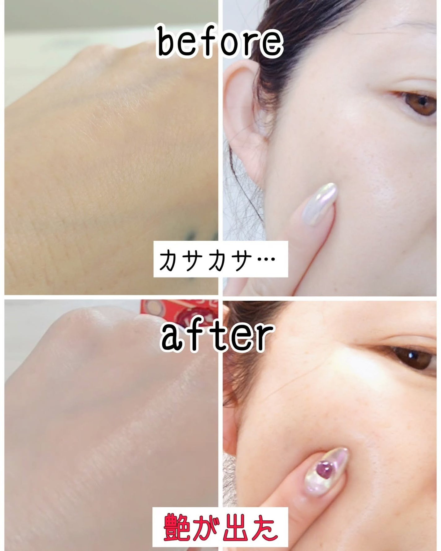 oyakiðïžãã©ãã100 on LIPS ããã£ãšã&ã·ããèâ¡ç®æãæã¯ãã¯ãã³ã³ðªè²ã
èæ©ã¿ã¯çµ¶ããªã..ãïŒ4æç®ïŒ