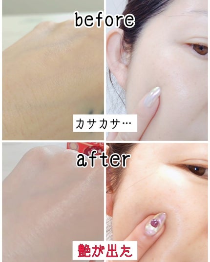 oyakiðïžãã©ãã100 on LIPS ããã£ãšã&ã·ããèâ¡ç®æãæã¯ãã¯ãã³ã³ðªè²ã
èæ©ã¿ã¯çµ¶ããªã..ãïŒ4æç®ïŒ