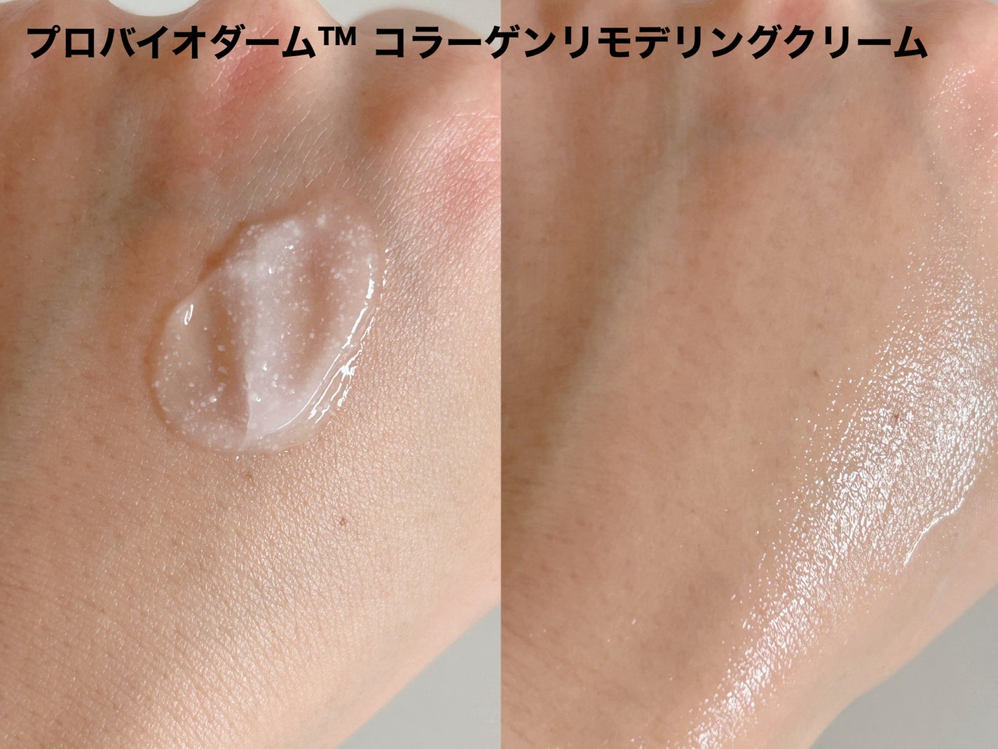 ãã€ãªããŒã«ã ãããã€ãªããŒã 3Dãªããã£ã³ã°ã¯ãªãŒã /BIOHEAL BOH/ãã§ã€ã¹ã¯ãªãŒã ã䜿ã£ãã¯ãã³ãïŒ4æç®ïŒ