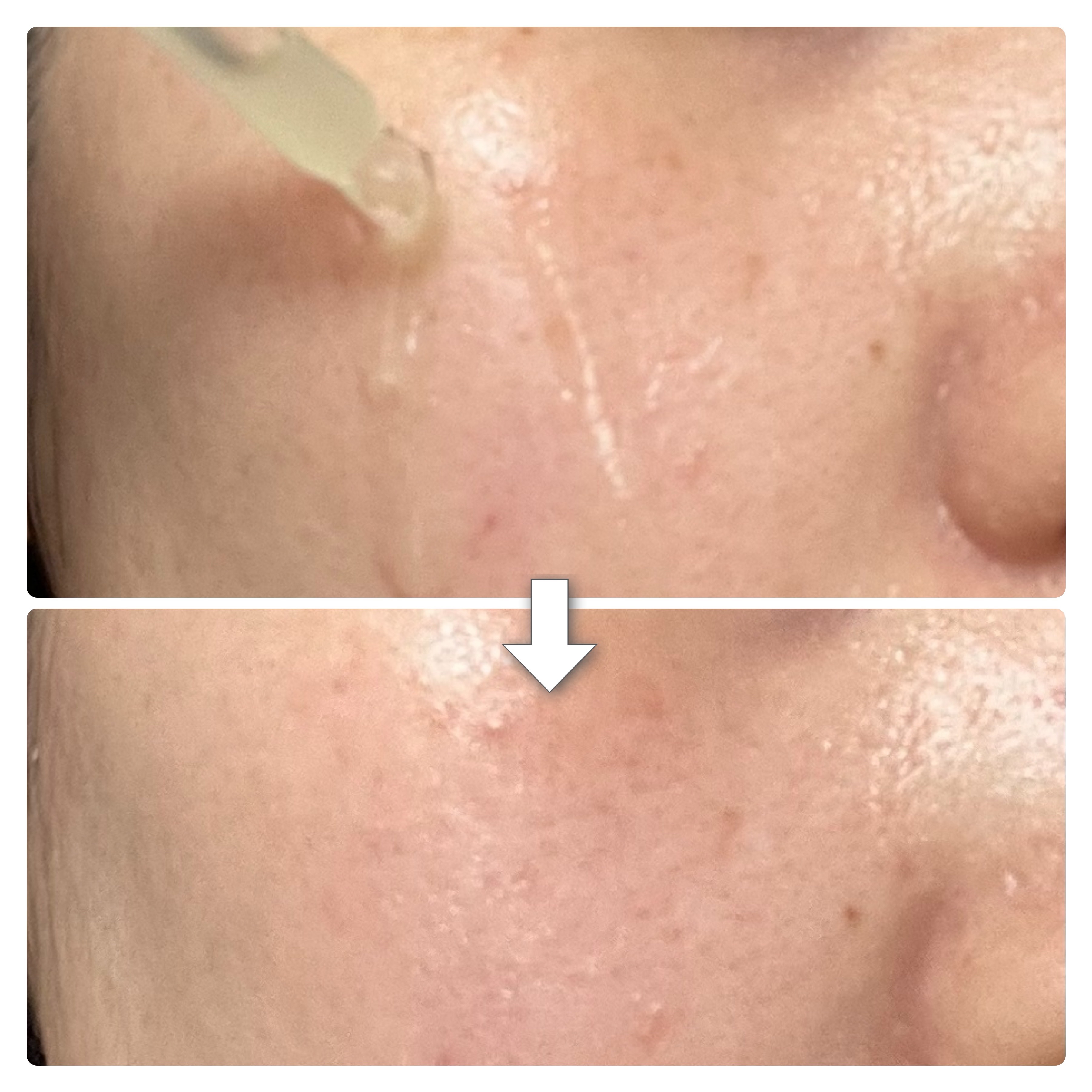 青麦ジンクセラム/Veganifect/美容液を使ったクチコミ（3枚目）