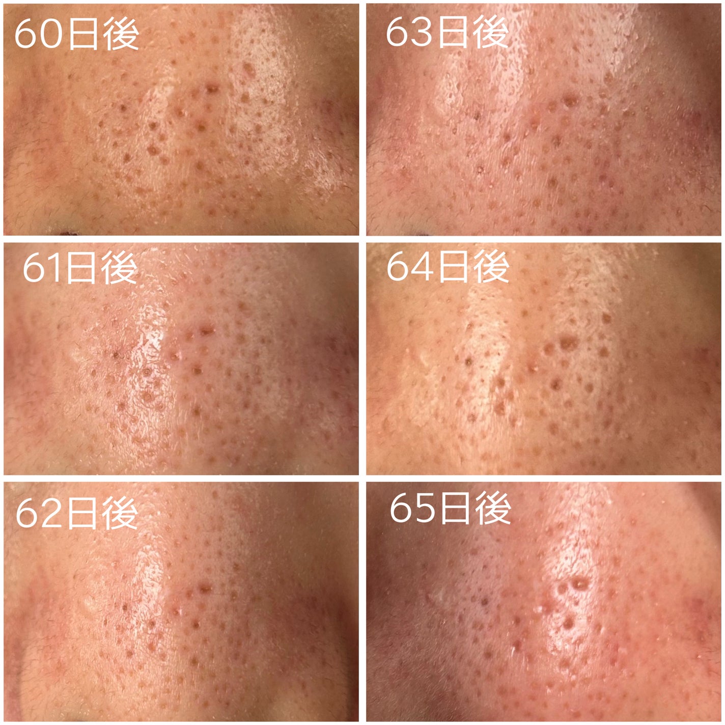 レチノール0.3 ナイアシンリニューイングセラム/Anua/美容液を使ったクチコミ(3枚目)