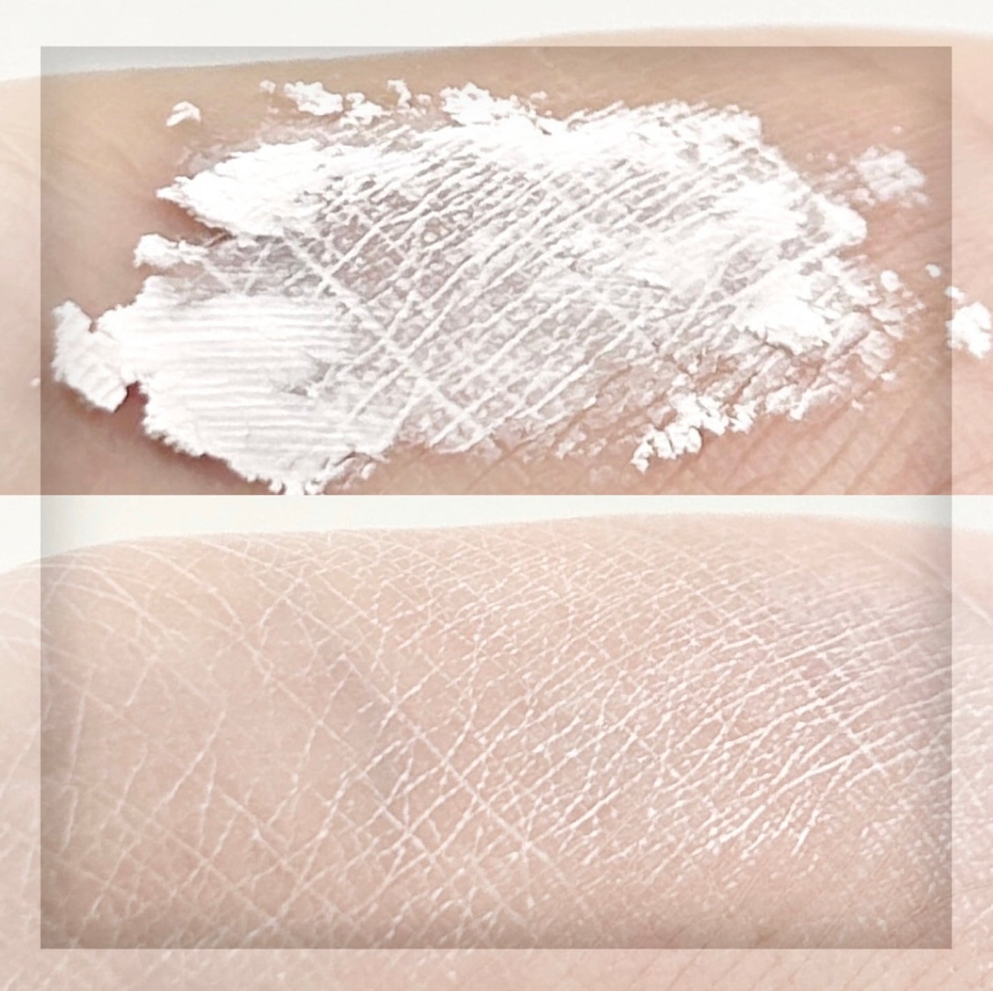 ジンクテカBセラムセット/BRING GREEN/スキンケアキットを使ったクチコミ(10枚目)