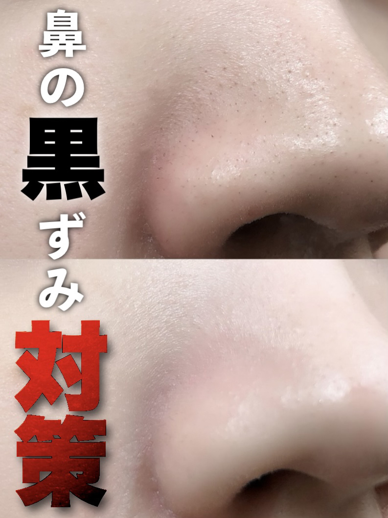 スムースクレンジングバーム ディープブラック GL+/PERFECT ONE  FOCUS/クレンジングバームを使ったクチコミ（1枚目）