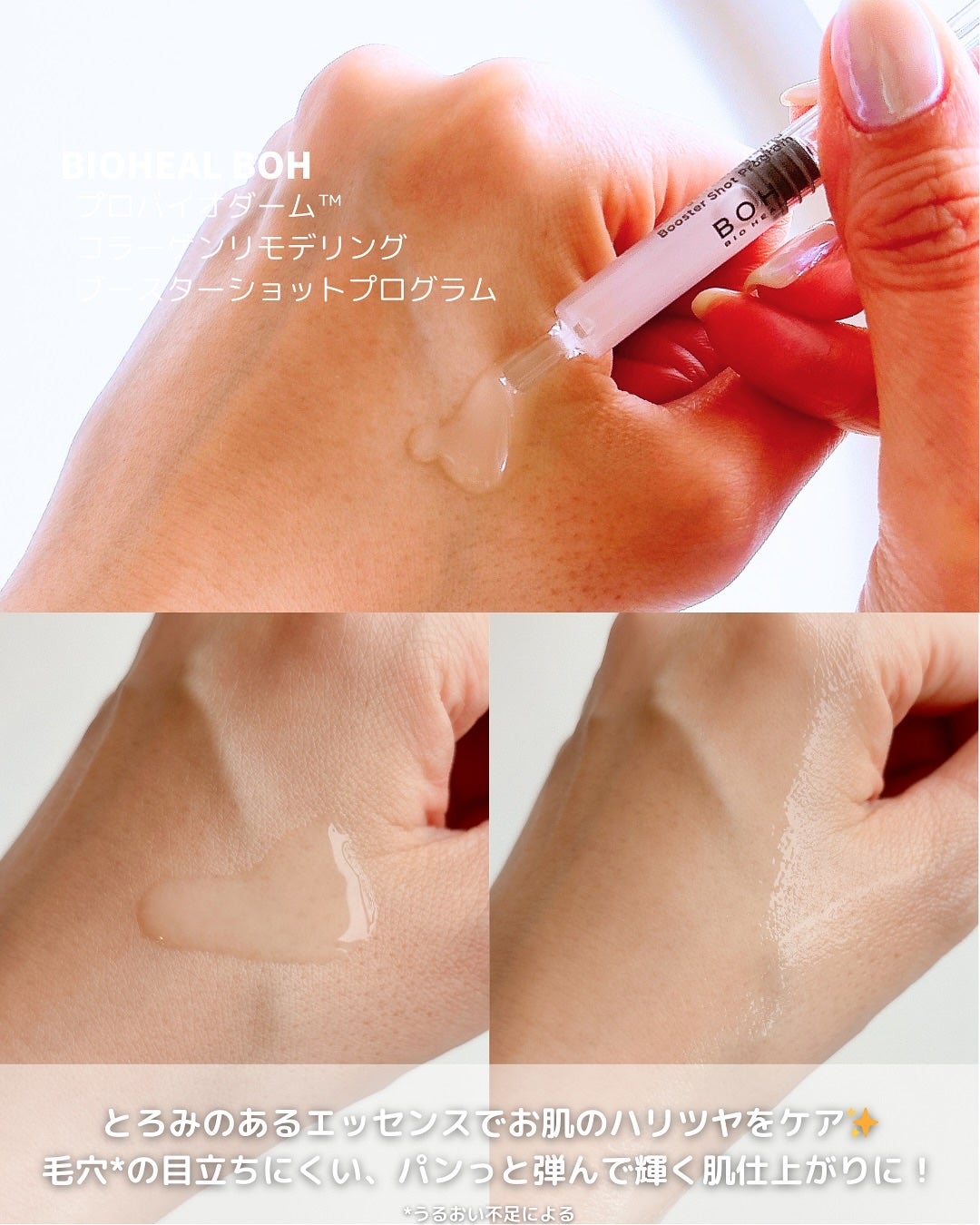 プロバイオダーム™ コラーゲン リモデリング ブースターショット プログラム/BIOHEAL BOH/美容液を使ったクチコミ(6枚目)