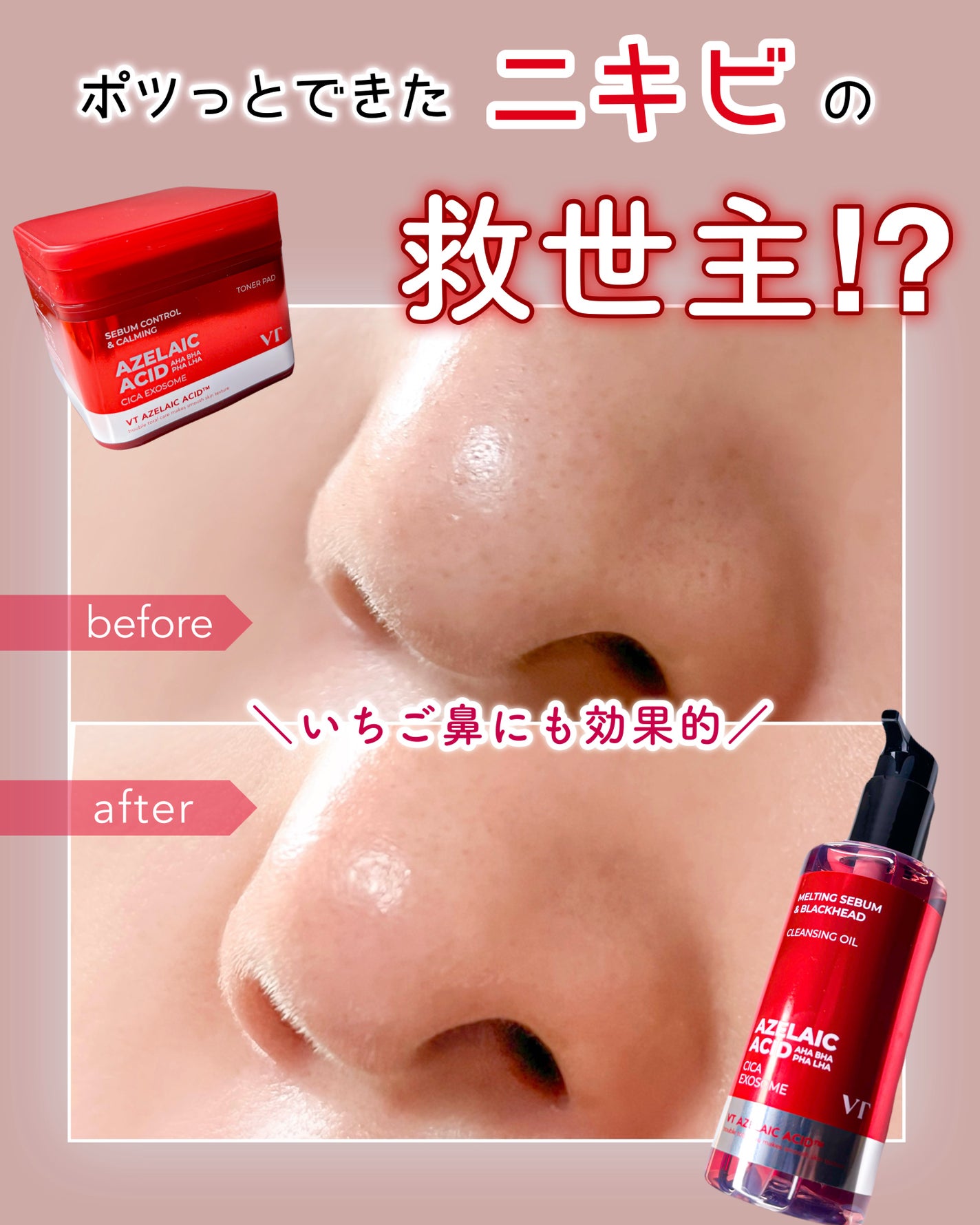 AZケア クレンジングオイル/VT/オイルクレンジングを使ったクチコミ(1枚目)