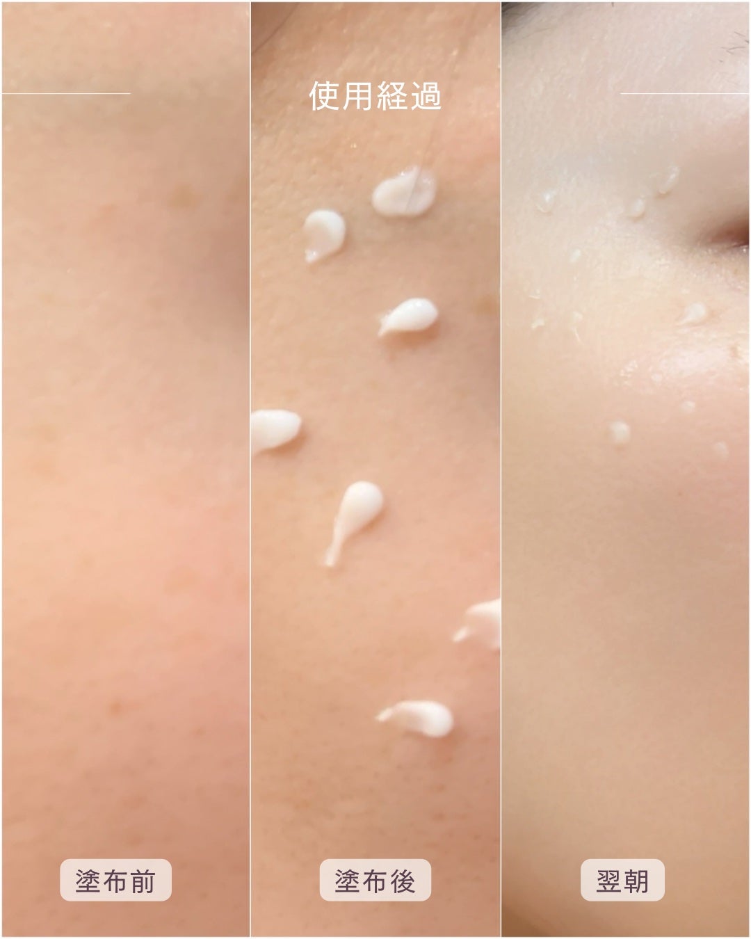 メラトニンクリーム/東亜製薬/フェイスクリームを使ったクチコミ(6枚目)