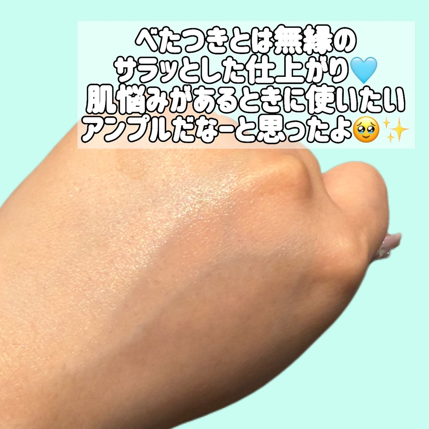 ダーマアンサーアゼライン酸ミントアンプル/CNP Laboratory/美容液を使ったクチコミ(4枚目)