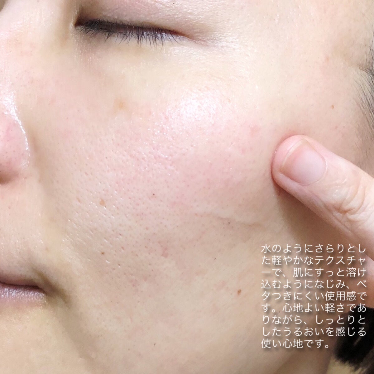 ガラク ナイアシン 3.0 エッセンス/manyo/美容液を使ったクチコミ(3枚目)