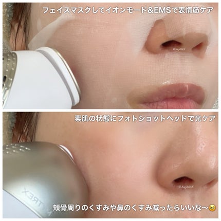 MiRAY ONE/MYTREX/美顔器・マッサージを使ったクチコミ(5枚目)