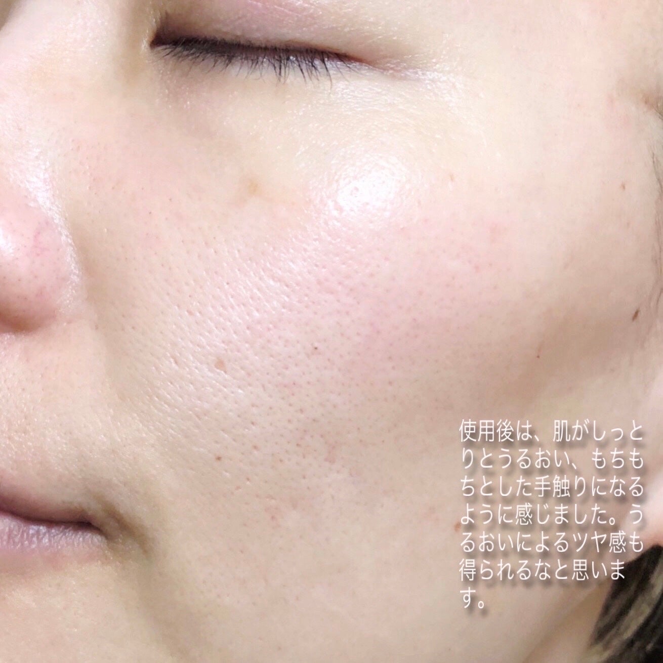 クローザーセラム/Frankly/美容液を使ったクチコミ(4枚目)