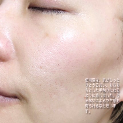 クローザーセラム/Frankly/美容液を使ったクチコミ(4枚目)