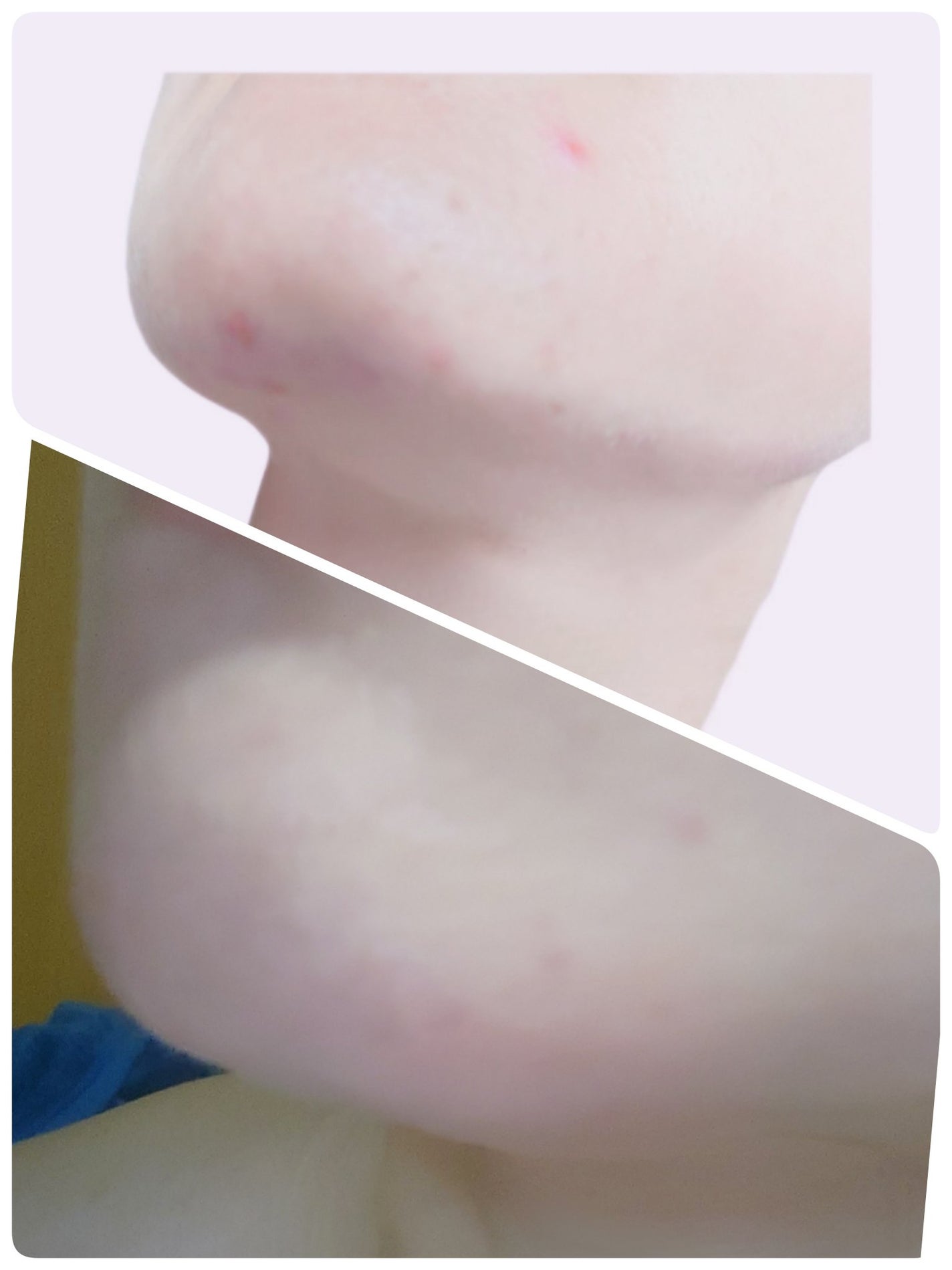 A1カーミング アンプル/VT/美容液を使ったクチコミ(3枚目)