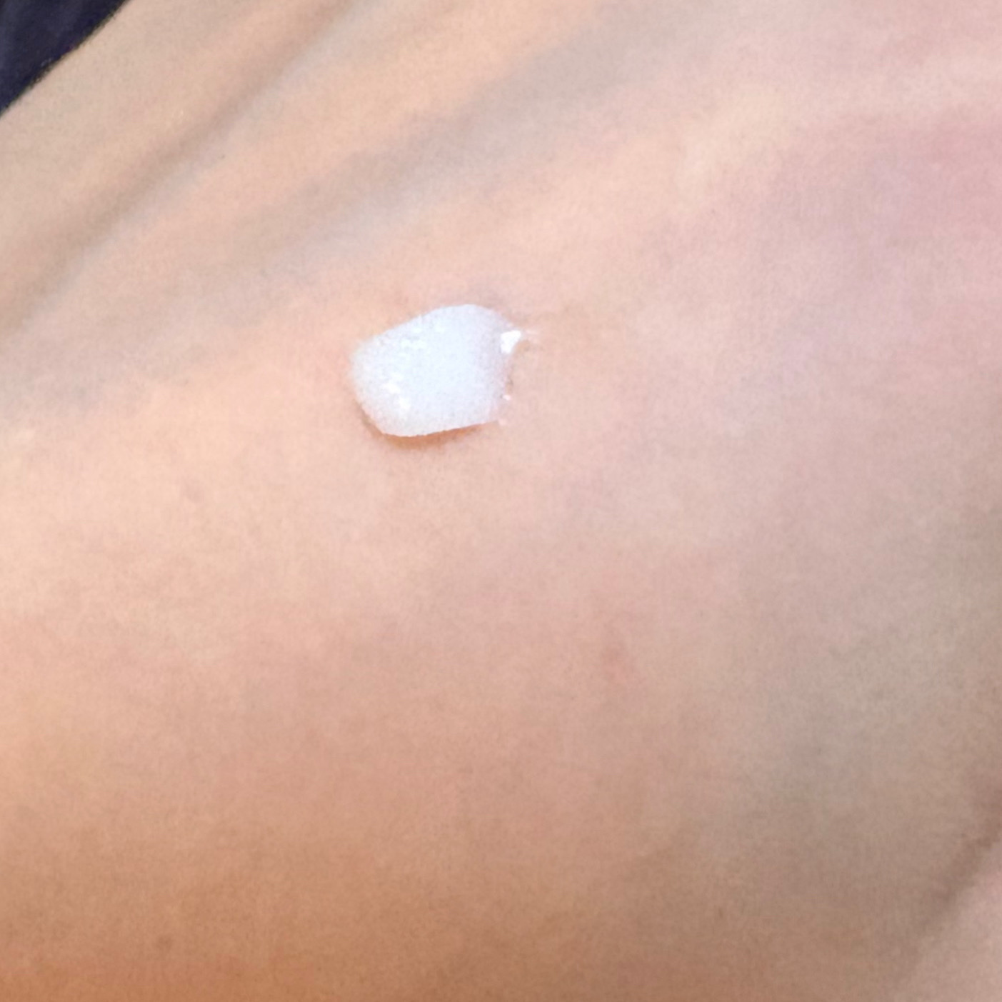 ガーリック リードルショット スポットクリーム/VT/フェイスクリームを使ったクチコミ（3枚目）