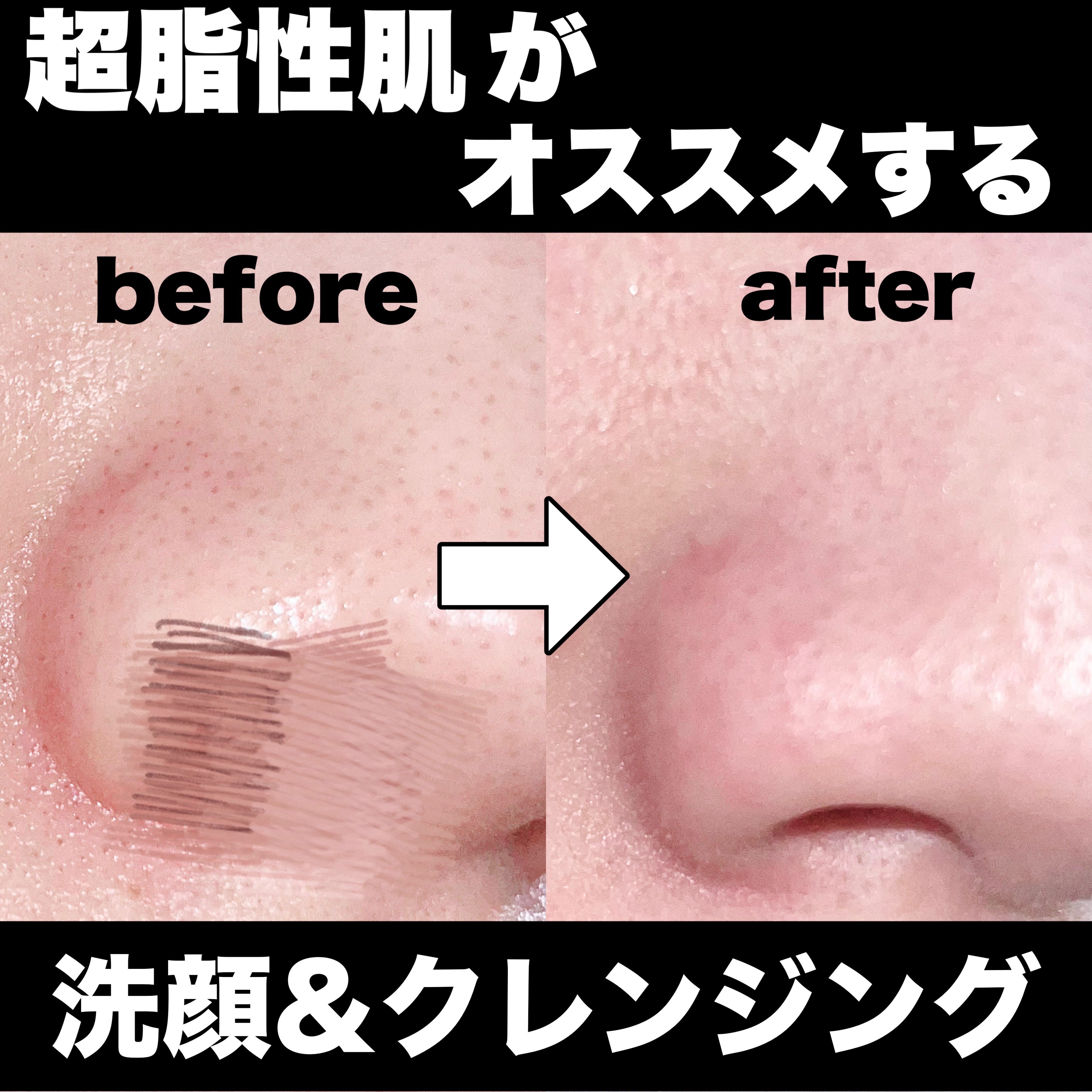 マイルドクレンジング オイル/ファンケル/オイルクレンジングを使ったクチコミ（1枚目）