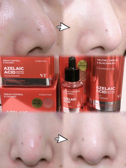 A1カーミング アンプル/VT/美容液を使ったクチコミ(5枚目)