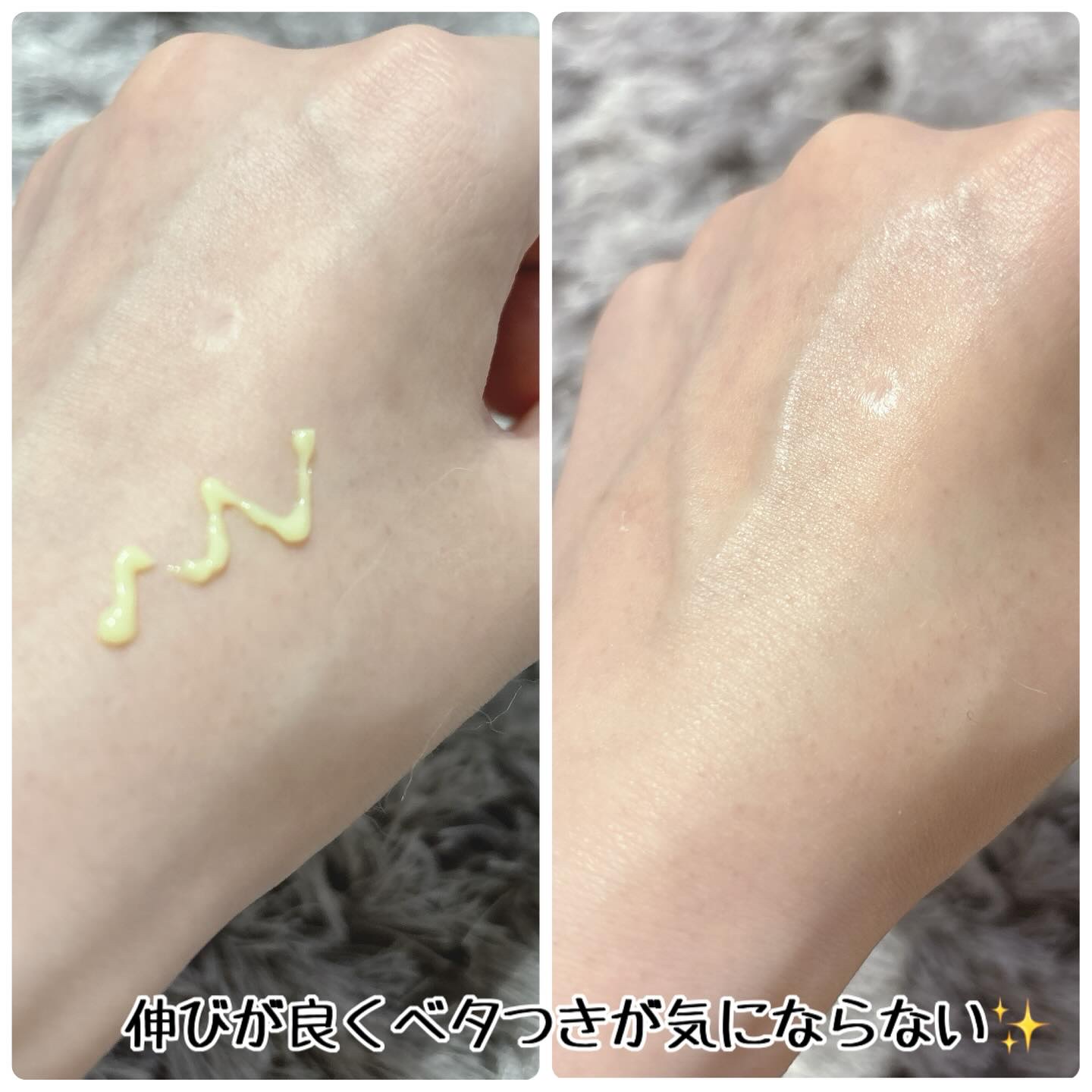 VITALIFT A forte/Dr.Different/フェイスクリームを使ったクチコミ（2枚目）