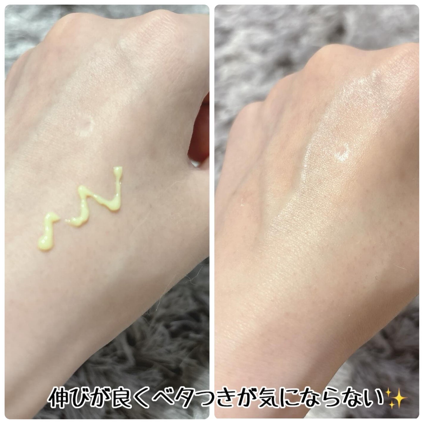 VITALIFT A forte/Dr.Different/フェイスクリームを使ったクチコミ(2枚目)