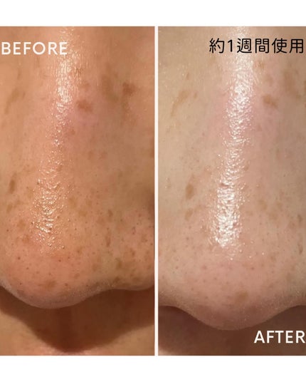 A1カーミング アンプル/VT/美容液を使ったクチコミ(4枚目)