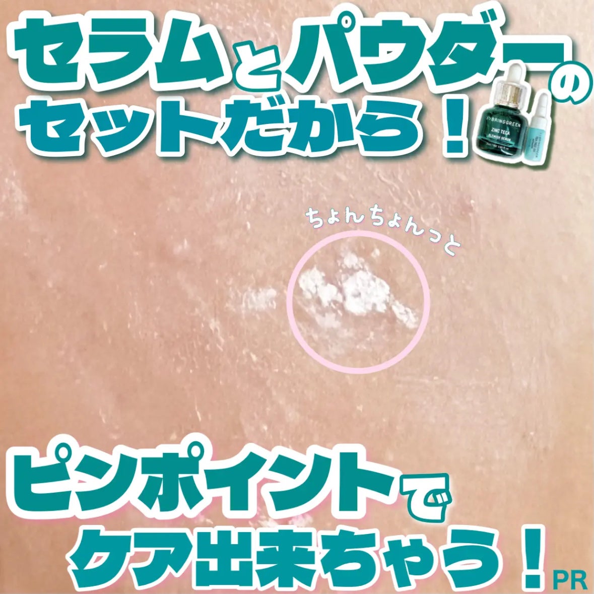 ジンクテカBセラムセット/BRING GREEN/スキンケアキットを使ったクチコミ(3枚目)