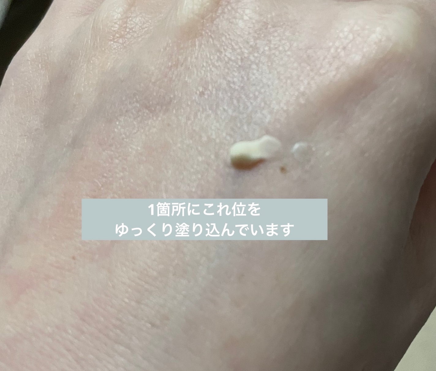 ホワイトショット SXS N/ホワイトショット/美容液を使ったクチコミ(2枚目)