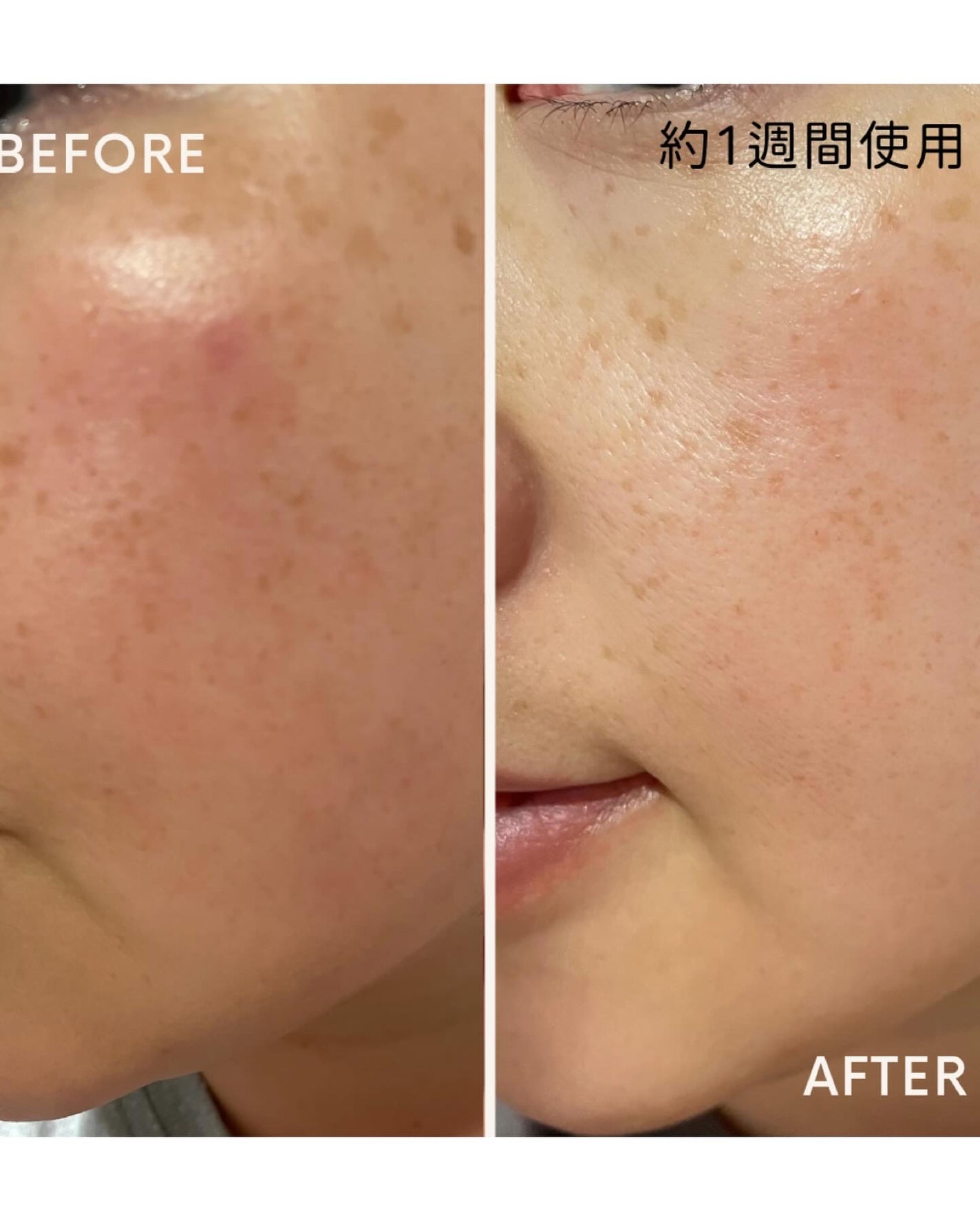 A1カーミング アンプル/VT/美容液を使ったクチコミ(7枚目)