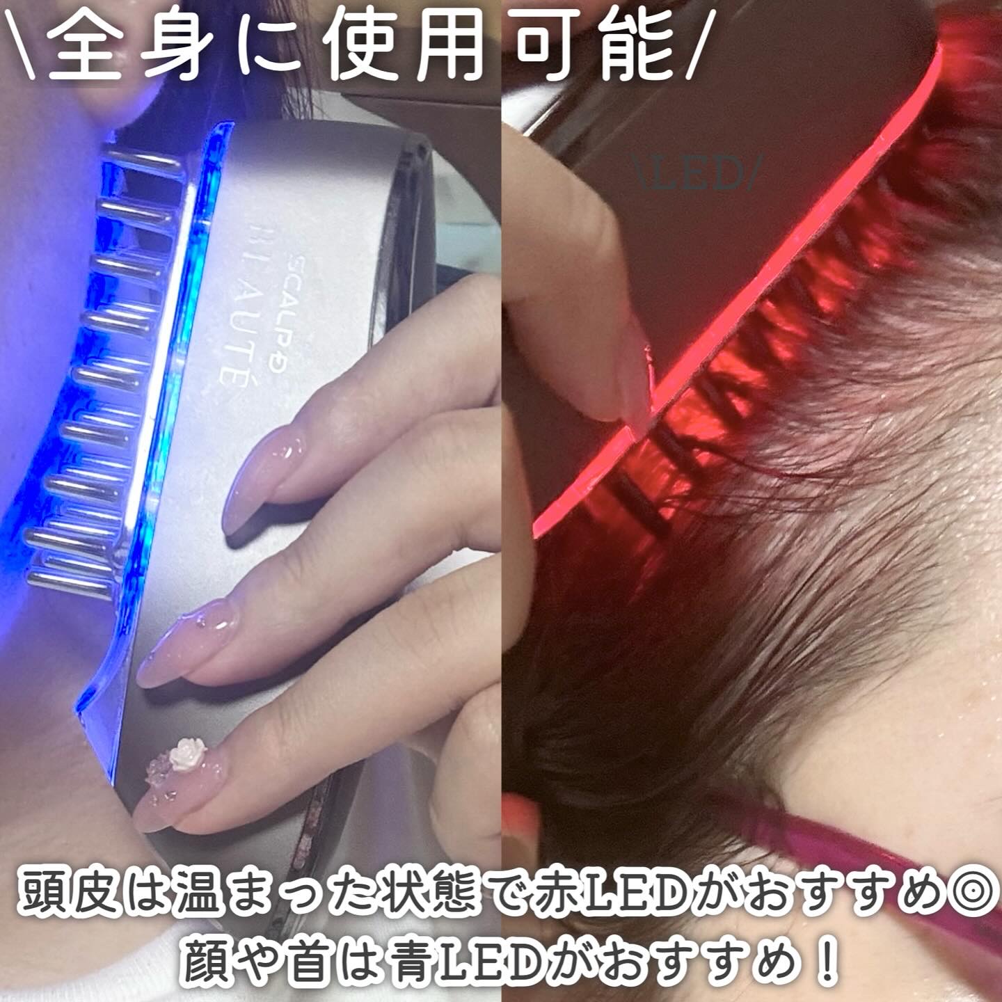 スカルプ電気ブラシ｜アンファー(スカルプD)の効果に関する口コミ