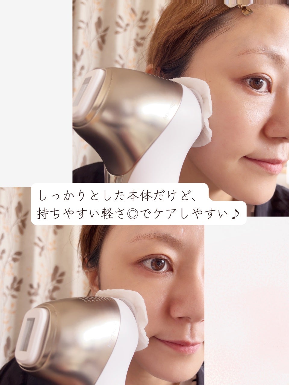 MiRAY ONE/MYTREX/美顔器・マッサージを使ったクチコミ(6枚目)