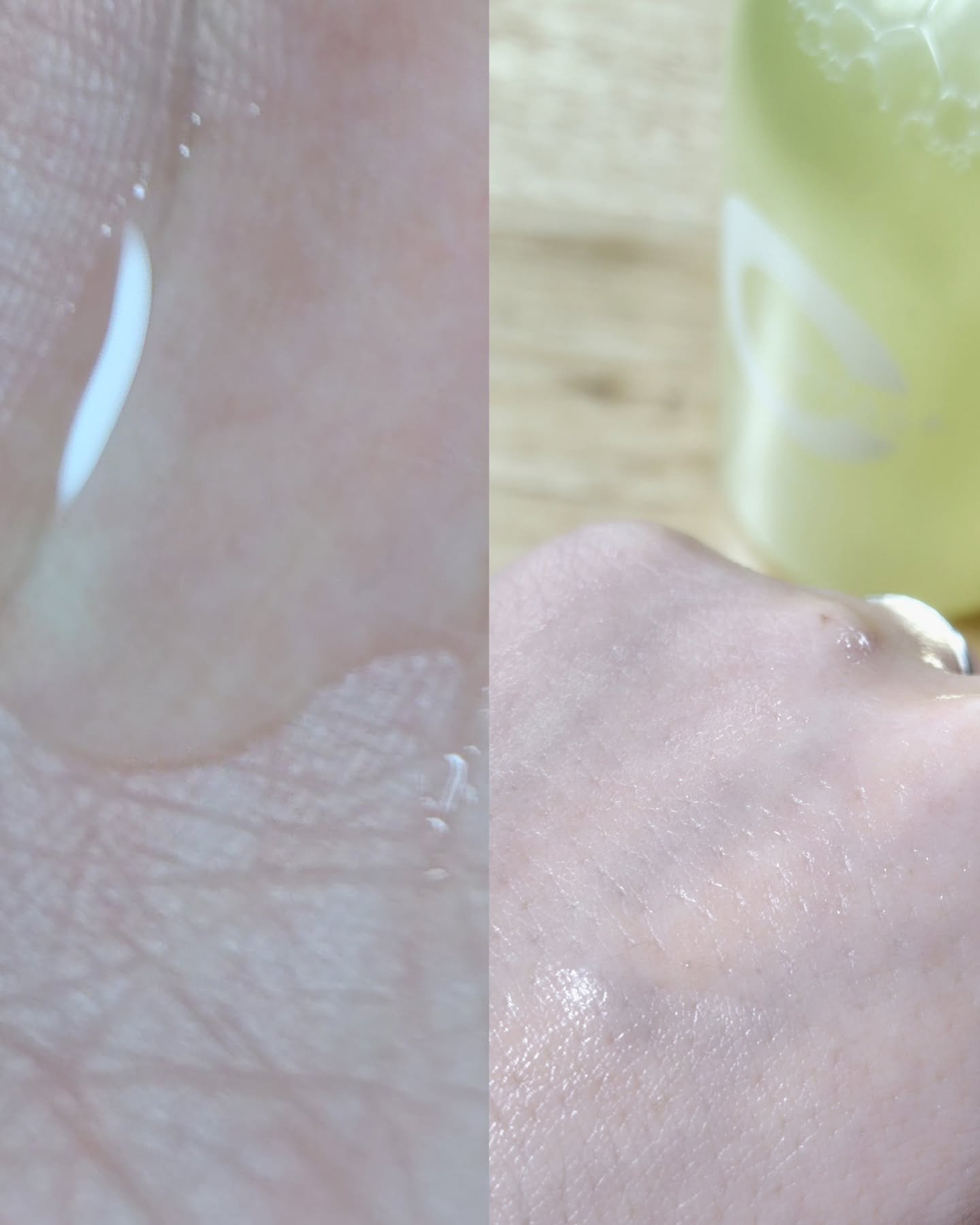 CVITAS Ｃローション＋/CVITAS/化粧水を使ったクチコミ（3枚目）