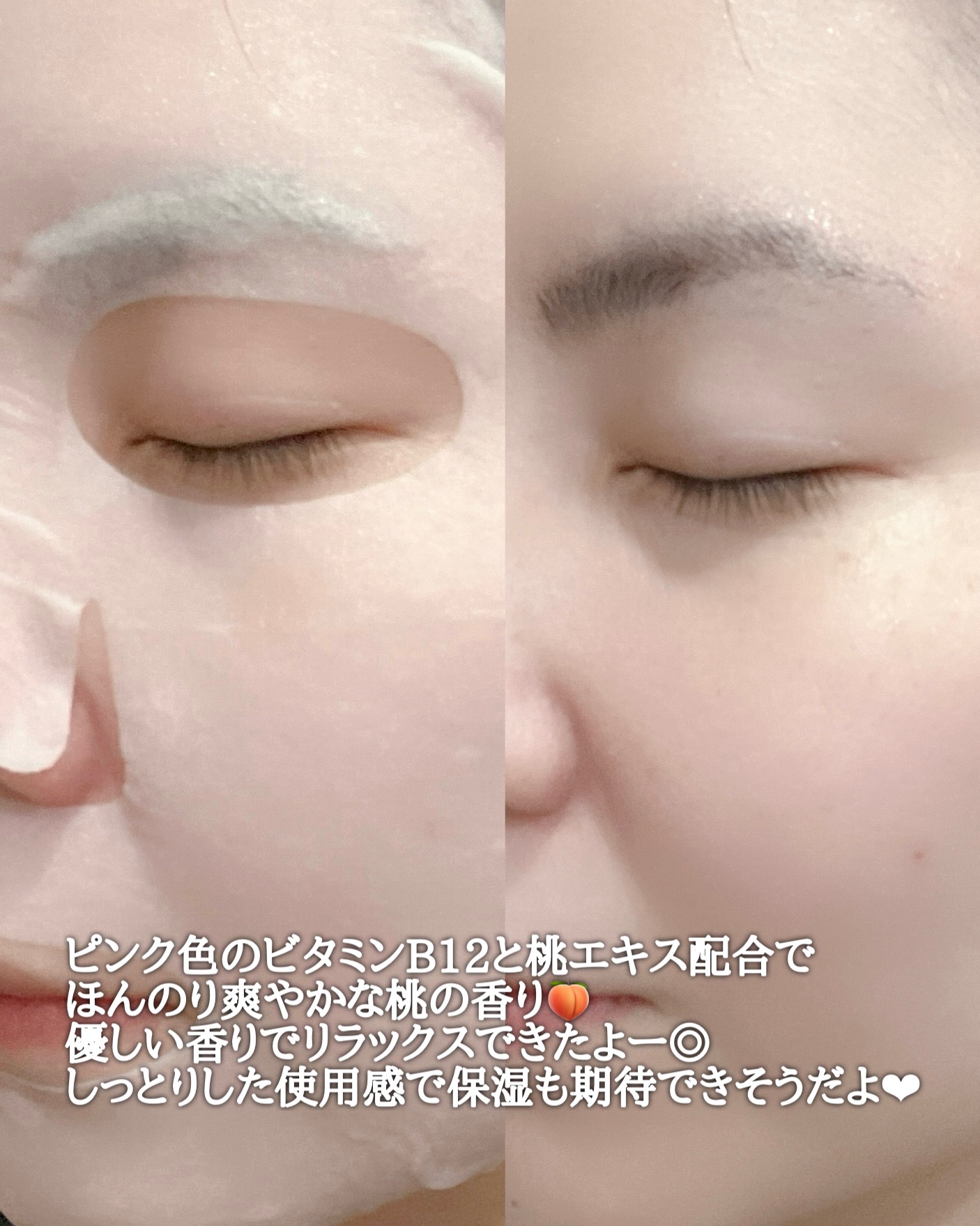 桃70％ナイアシンシートマスク/Anua/シートマスク・パックを使ったクチコミ（3枚目）