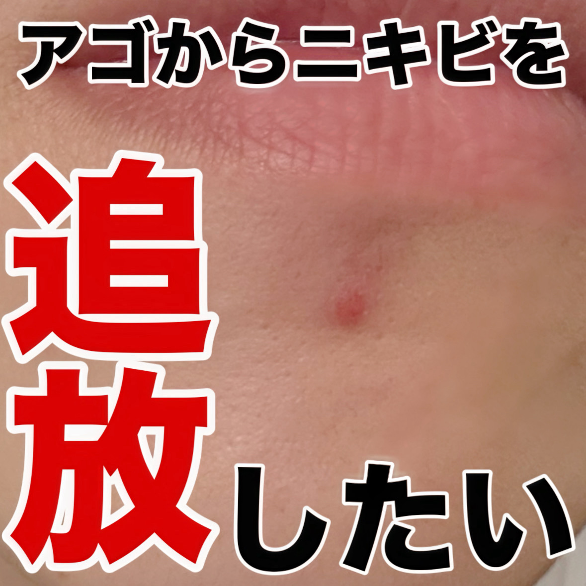 ガーリック リードルショット スポットクリーム/VT/フェイスクリームを使ったクチコミ（1枚目）