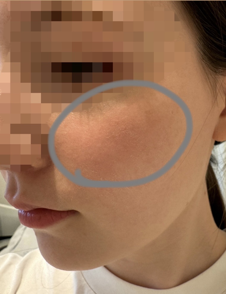 ペリペラ シロッピー トック チーク/PERIPERA/リキッドチークを使ったクチコミ（3枚目）